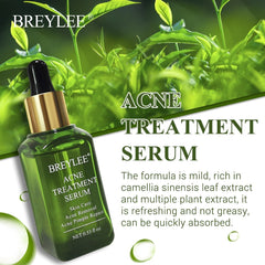 BREYLEE Acne Treatment Serum Face Facial Anti Acne Scar Removal Cream Skin Care Whitening Repair Pimple Remover For Acne - XMART