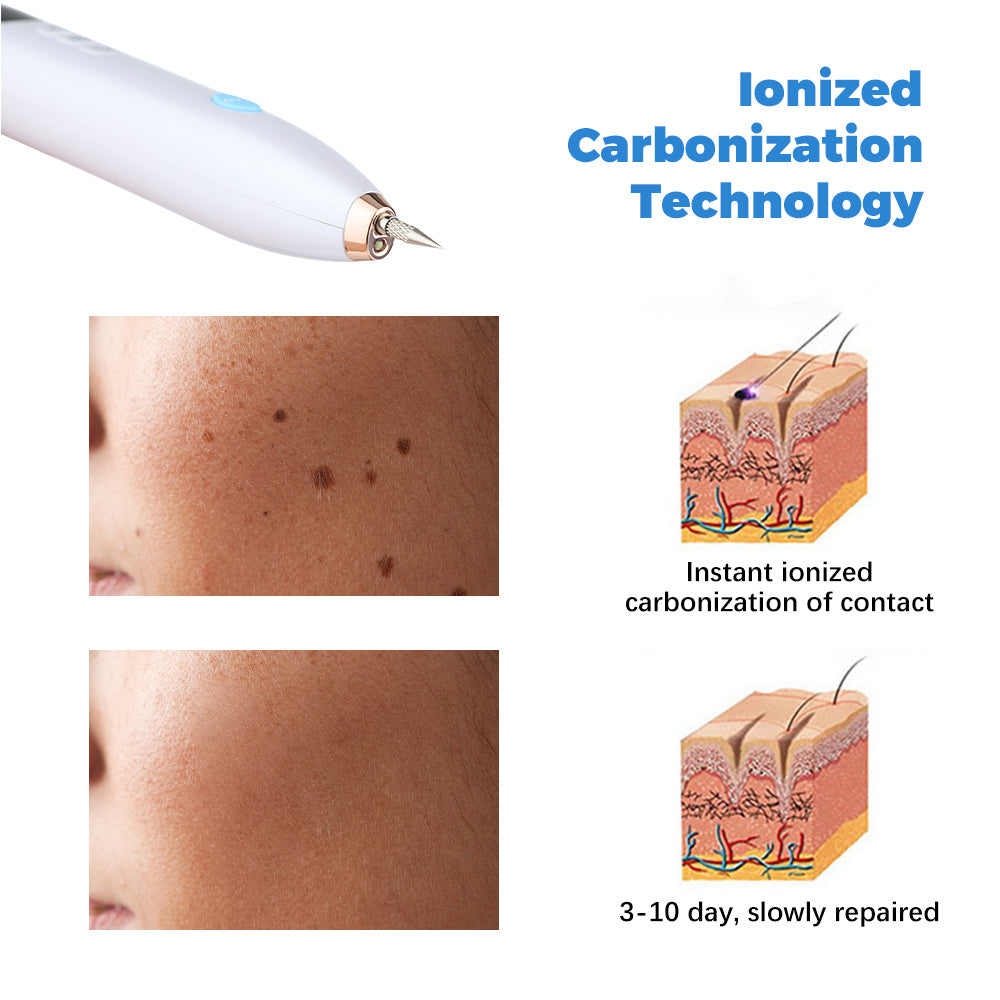 Laser Skin Tag Remover Face Mole Remove Plasma Pen Freckle Removal Machine Plasma Remove Scar Black Spot Face Wart Tattoo Device - XMART