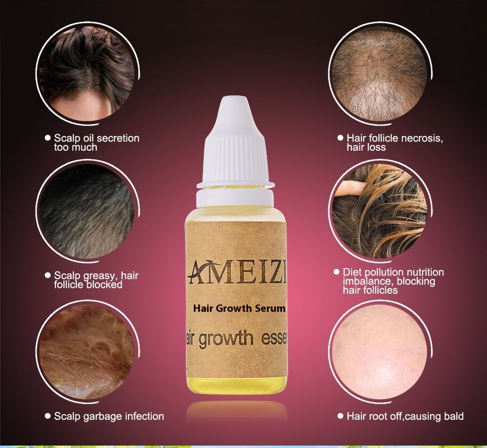 Hair Growth anti Hair Loss Liquid 20ml - XMART