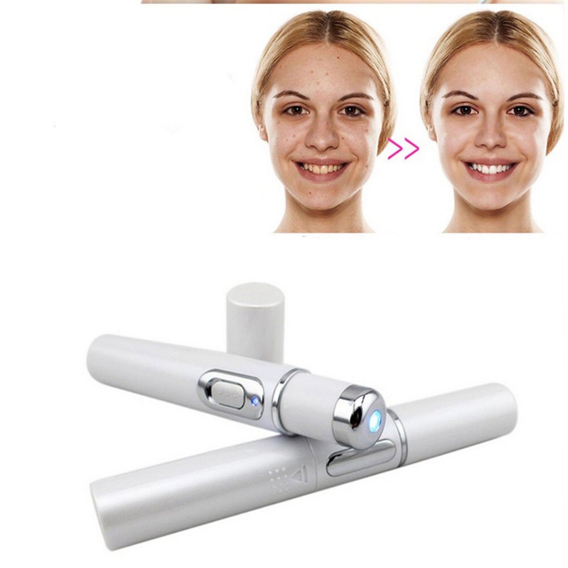 Wrinkle Blemish Pore Acne Scar Remover Pen - XMART
