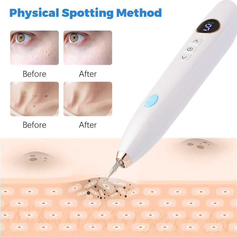 Laser Skin Tag Remover Face Mole Remove Plasma Pen Freckle Removal Machine Plasma Remove Scar Black Spot Face Wart Tattoo Device - XMART