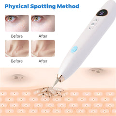 Laser Skin Tag Remover Face Mole Remove Plasma Pen Freckle Removal Machine Plasma Remove Scar Black Spot Face Wart Tattoo Device - XMART