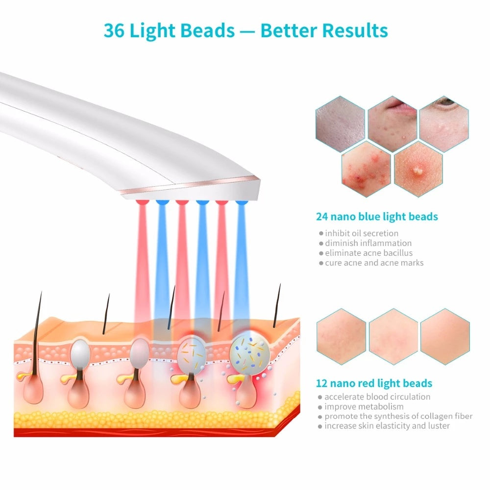 Acne Light Therapy Xpreen Wireless Rechargeable Light Acne Treatment Device Acne Clearing Eraser with Blue Light and Red Light - XMART