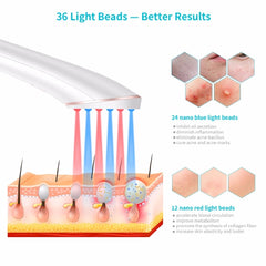 Acne Light Therapy Xpreen Wireless Rechargeable Light Acne Treatment Device Acne Clearing Eraser with Blue Light and Red Light - XMART
