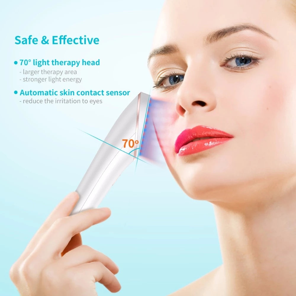 Acne Light Therapy Xpreen Wireless Rechargeable Light Acne Treatment Device Acne Clearing Eraser with Blue Light and Red Light - XMART