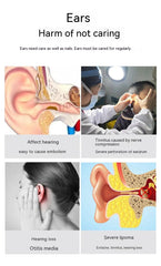 Wireless Smart HD Endoscope Luminous Ear Pick Ear Picking Tools - XMART